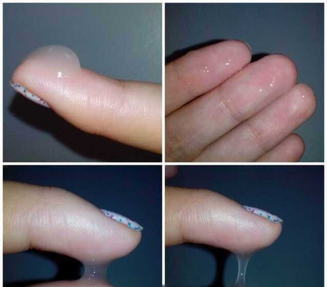 Male preseminal fluid during arousal