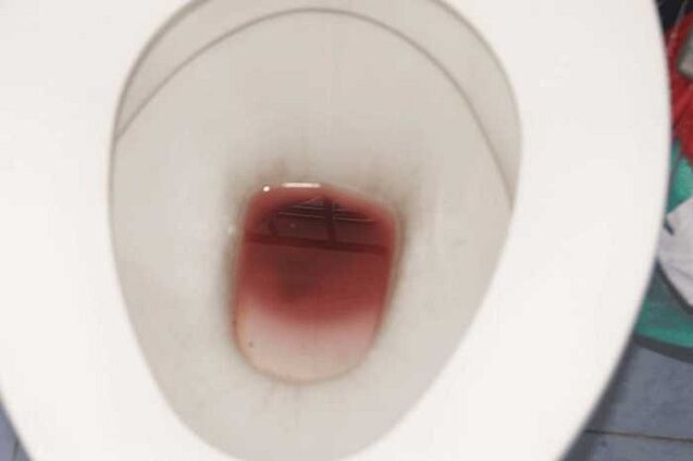 Spotting in men during arousal